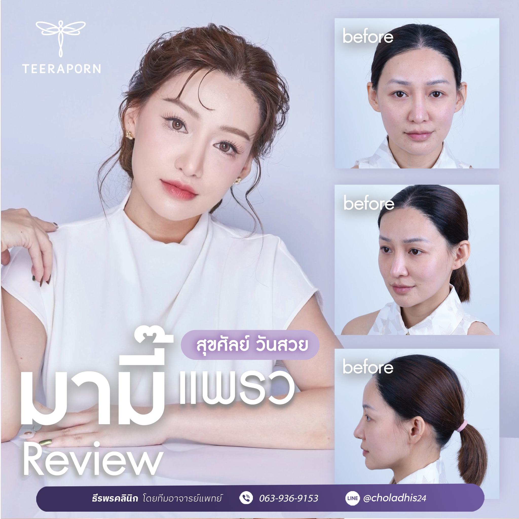 Gallery item name